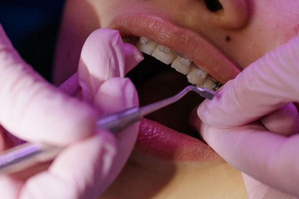 En qué momento es mejor para iniciar con el tratamiento de ortodoncia